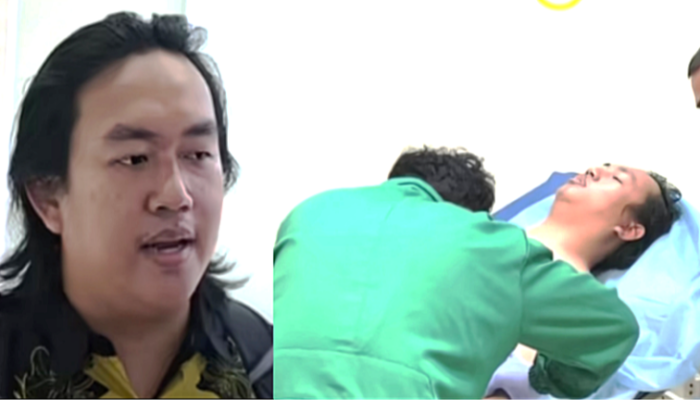 Korban Penyiraman Air Keras Andrie Yunus, Masih Dirawat