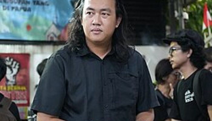 Kondisi Terkini Andrie Yunus, Korban Penyiraman Air Keras